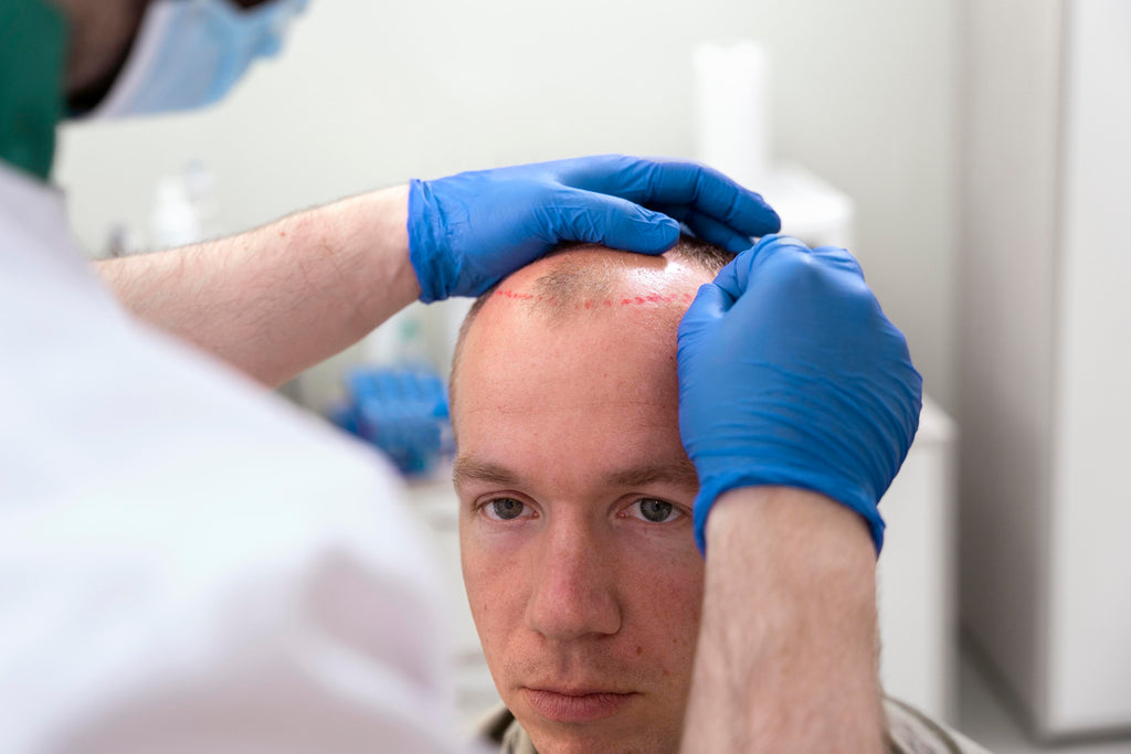 Why we prefer FUE method