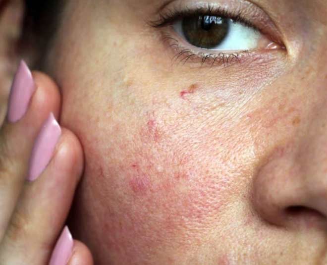 चेहरा धोने के बाद भी आता है ऑयल, ये गलतियां हो सकती हैं जिम्मेदार
