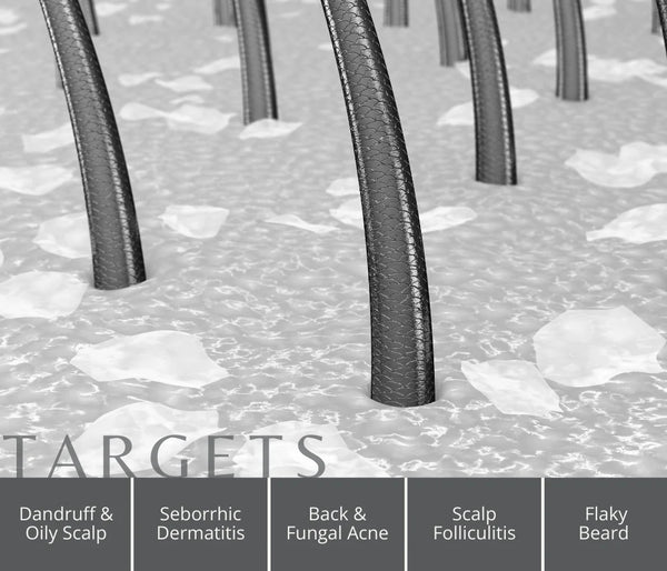 EnagenBio Degrease Pro Anti-Dandruff Scalp Serum