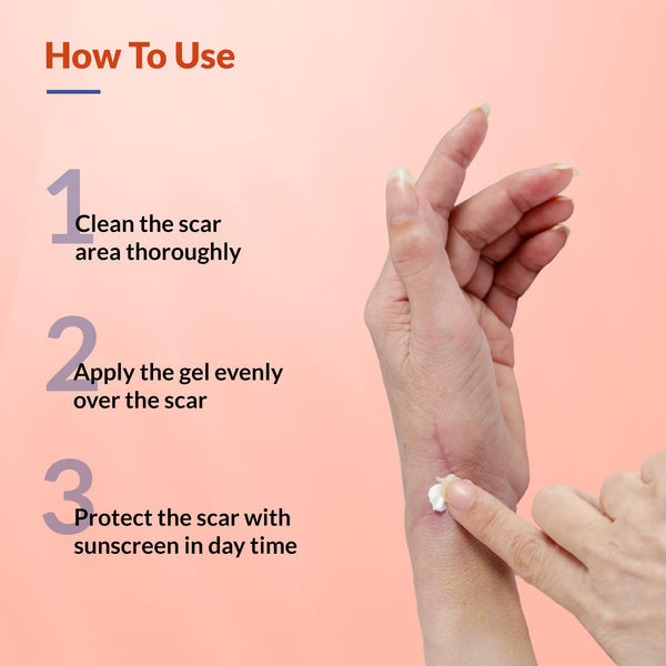 Fixderma Kelocepa Silicone Scar Gel