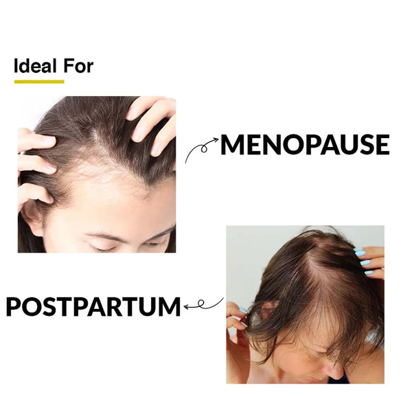 Fixderma Kairfoll Femme Specifique Shampoo