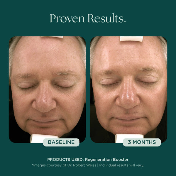 Regeneration Booster
