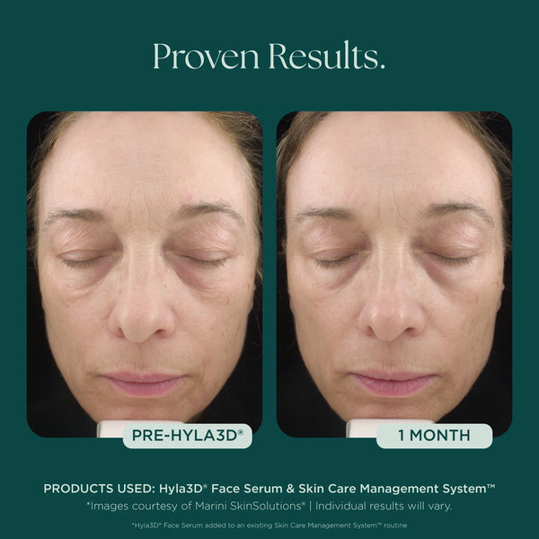 Hyla3D Face Serum Hyaluronic Acid Complex