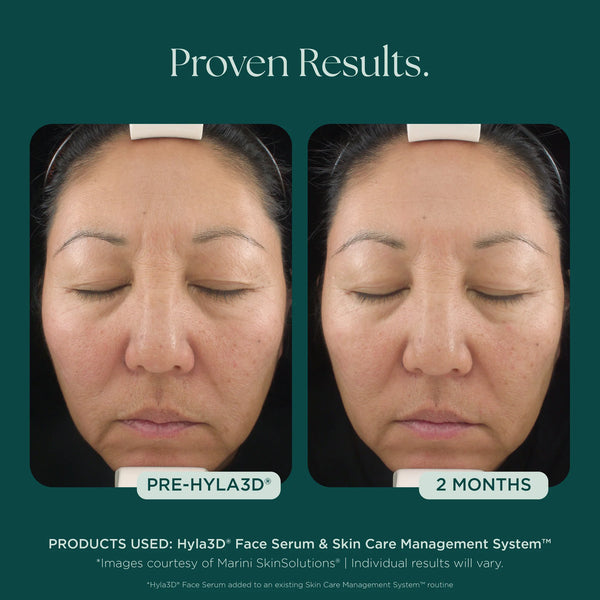 Hyla3D Face Serum Hyaluronic Acid Complex