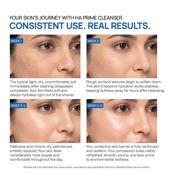 Yuderma HA Prime Hydro Infusion Moisturiser Foaming Cleanser
