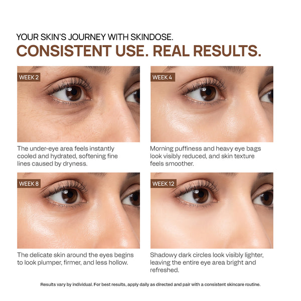 Yuderma Yuvenex Under Eye Gel