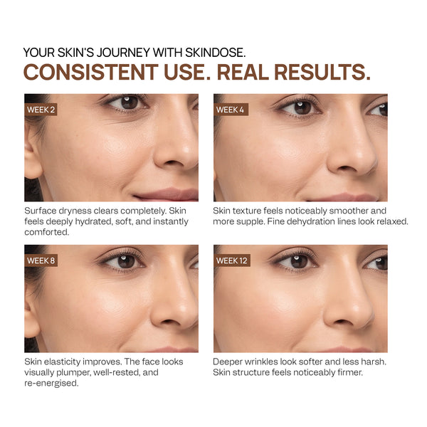 Yuderma Skindose Time Filler