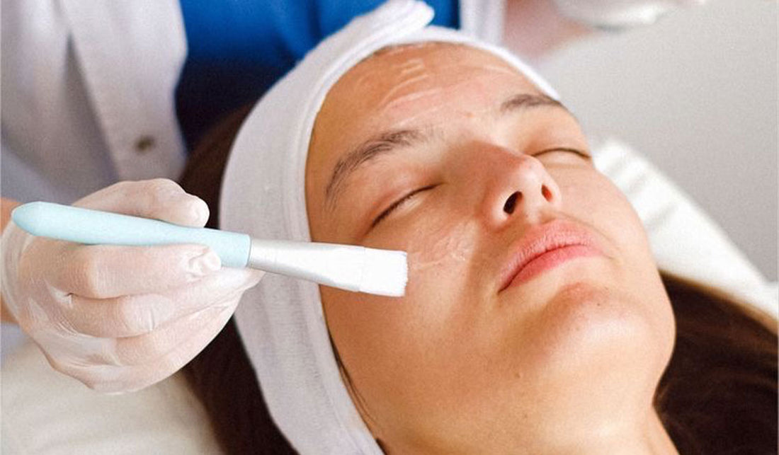 Benefits of Chemical Peels in Skincare