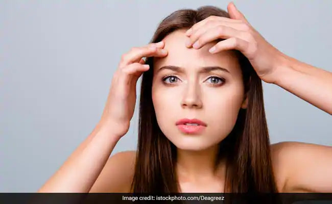 Can You Suddenly Become Allergic To A Product You Have Been Using For Years? Dermatologist Tells The Answer