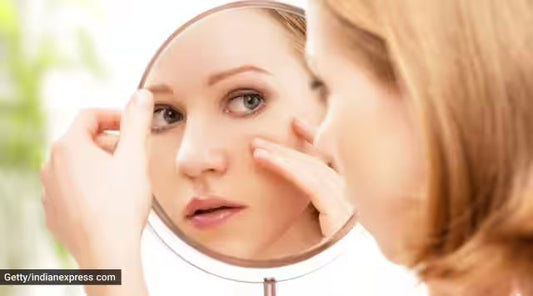 Simple tips to stop your face from looking oily and shiny