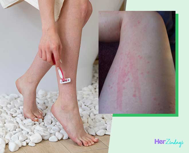 शेविंग के बाद होती है खुजली और जलन तो ये हैक्स आएंगे काम