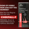 Chekfall-F 5% Topical Solution