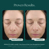 Hyla3D Face Serum Hyaluronic Acid Complex