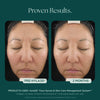 Hyla3D Face Serum Hyaluronic Acid Complex