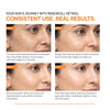 Renewcell Retinol | Diminish Fine Lines and Wrinkles