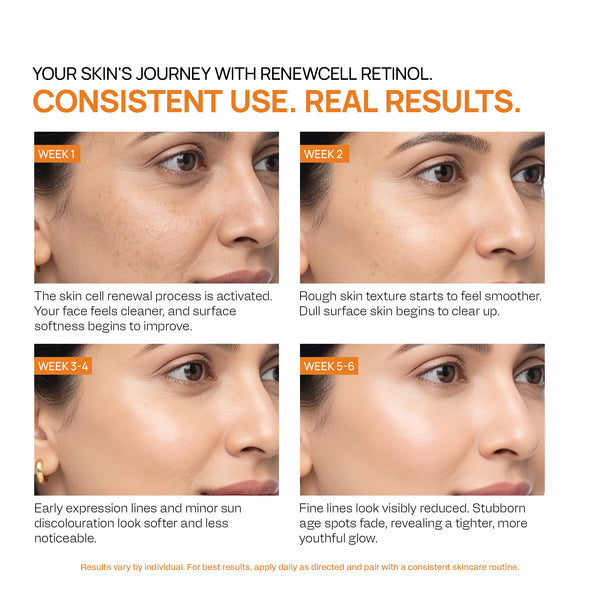 Renewcell Retinol | Diminish Fine Lines and Wrinkles