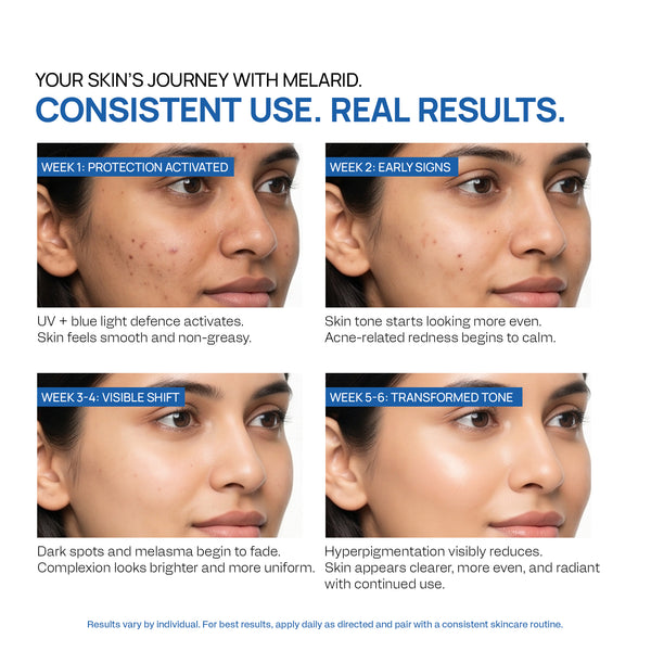 Yuderma Melarid Pigment Corrector Sunscreen SPF65 PA++++