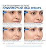 Yuderma Melarid-Trx Melano Correction Serum
