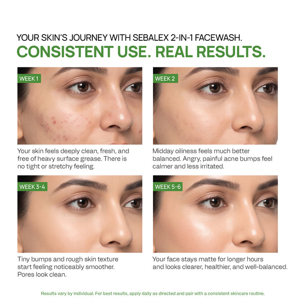 Sebalex Facewash